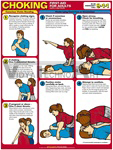 Choking First Aid For Adults Chart